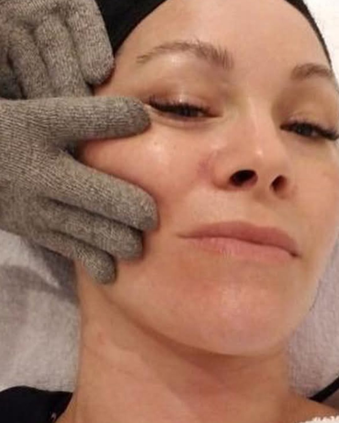 NeurotriS microcurrent treatment